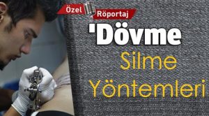 Dövme Silme Yöntemleri;