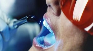 Eryaman Diş Hastanesi Ve Diş Sağlığı Konusunda Mükemmel Hizmetler