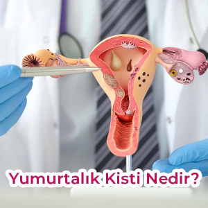 Yumurtalık Kisti Tedavisi: Kapsamlı Rehber ve Güncel Yaklaşımlar